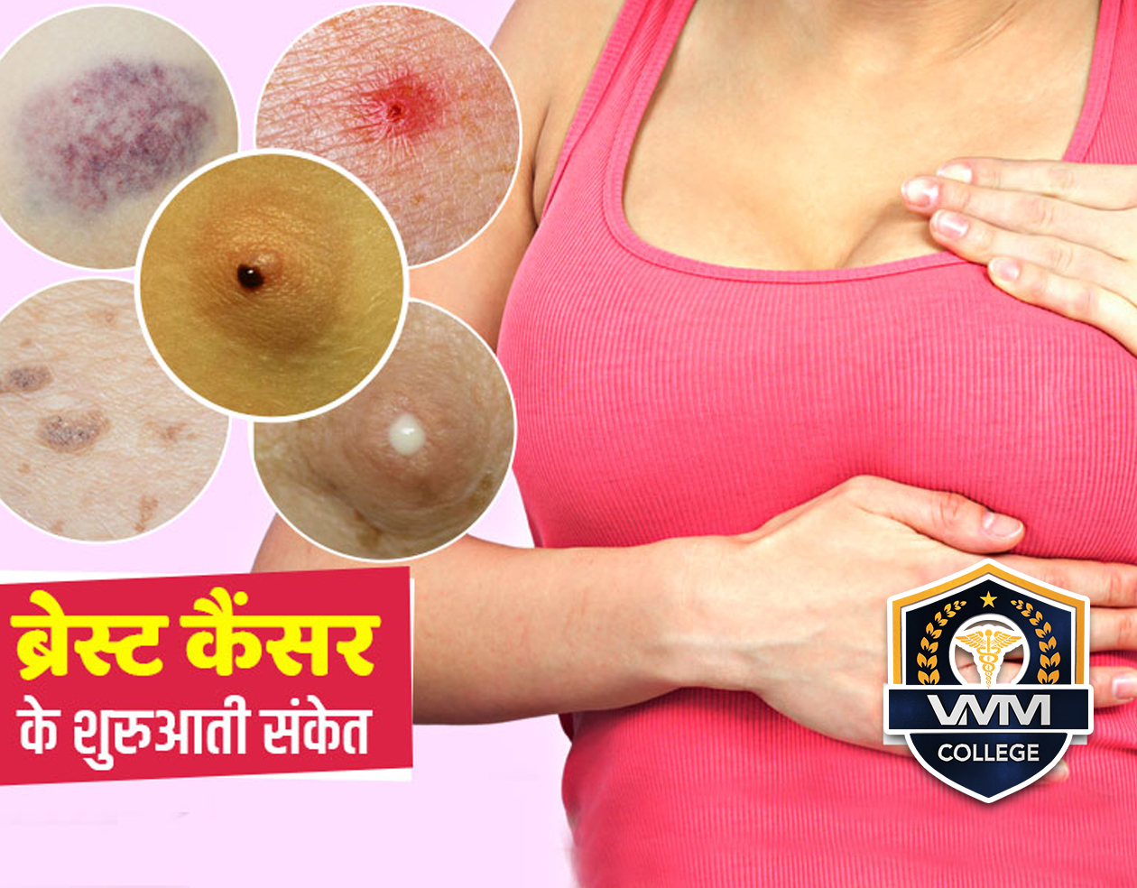 Breast cancer symptoms in Hindi | स्तन कैंसर के कारण, लक्षण और उपाय